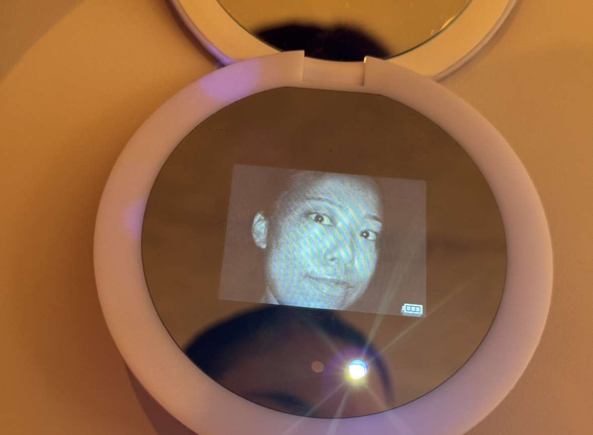 シミや肝斑のお悩みに私の私物購入品紹介