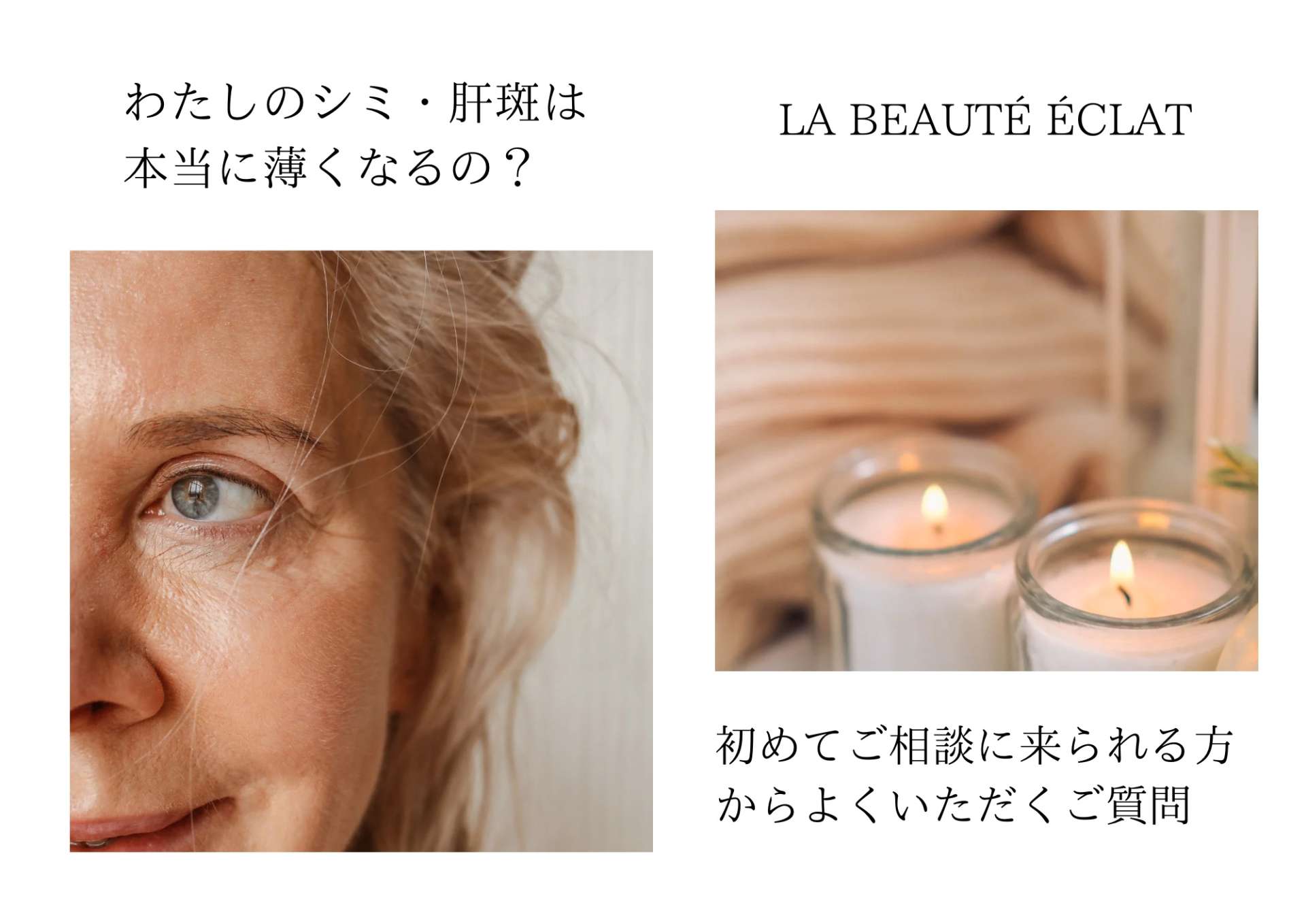 シミ・肝斑は“薄くなる”のか？