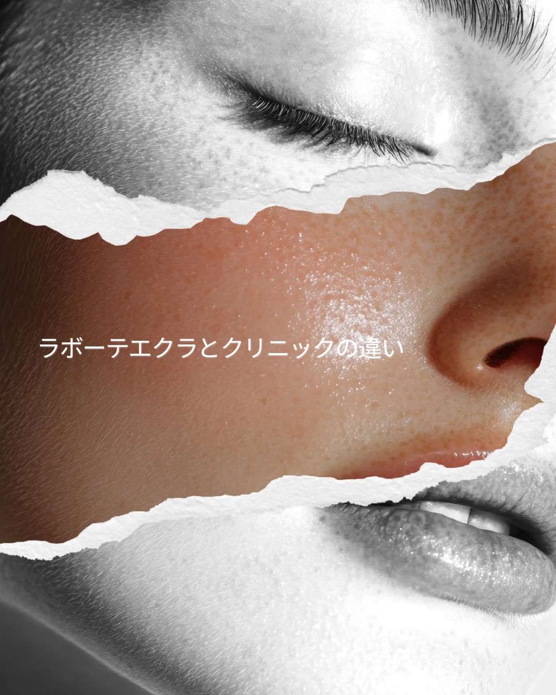 大阪・本町でシミや肝斑に悩むあなたへ 美容医療の時代でも、“育てながら改善する”という美しさの選び方」